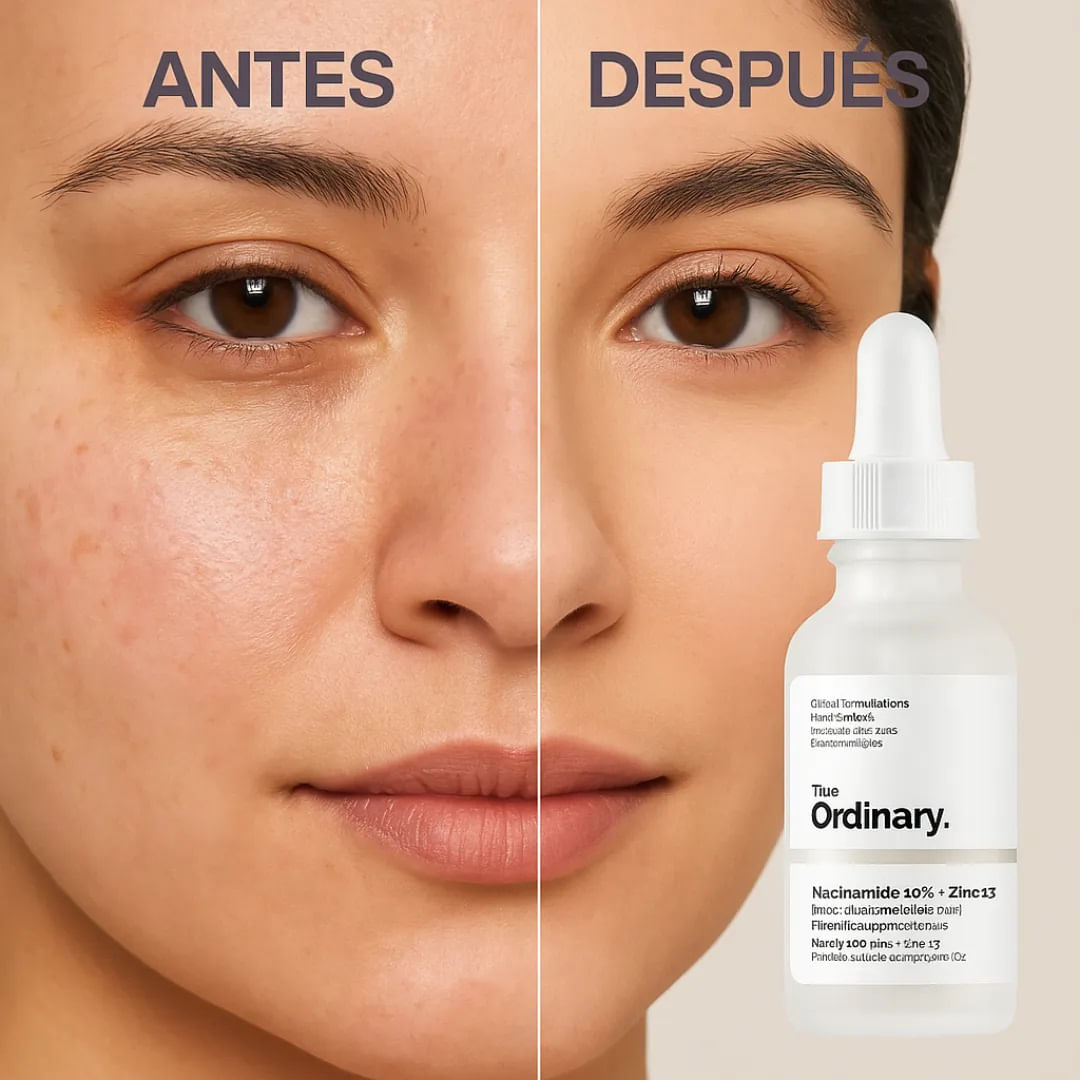 Ordinary Serum Hialurónico 30ml: Hidratación Profunda que Revitaliza tu Piel ✨